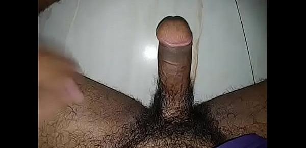  bangladesi hypospadias penis